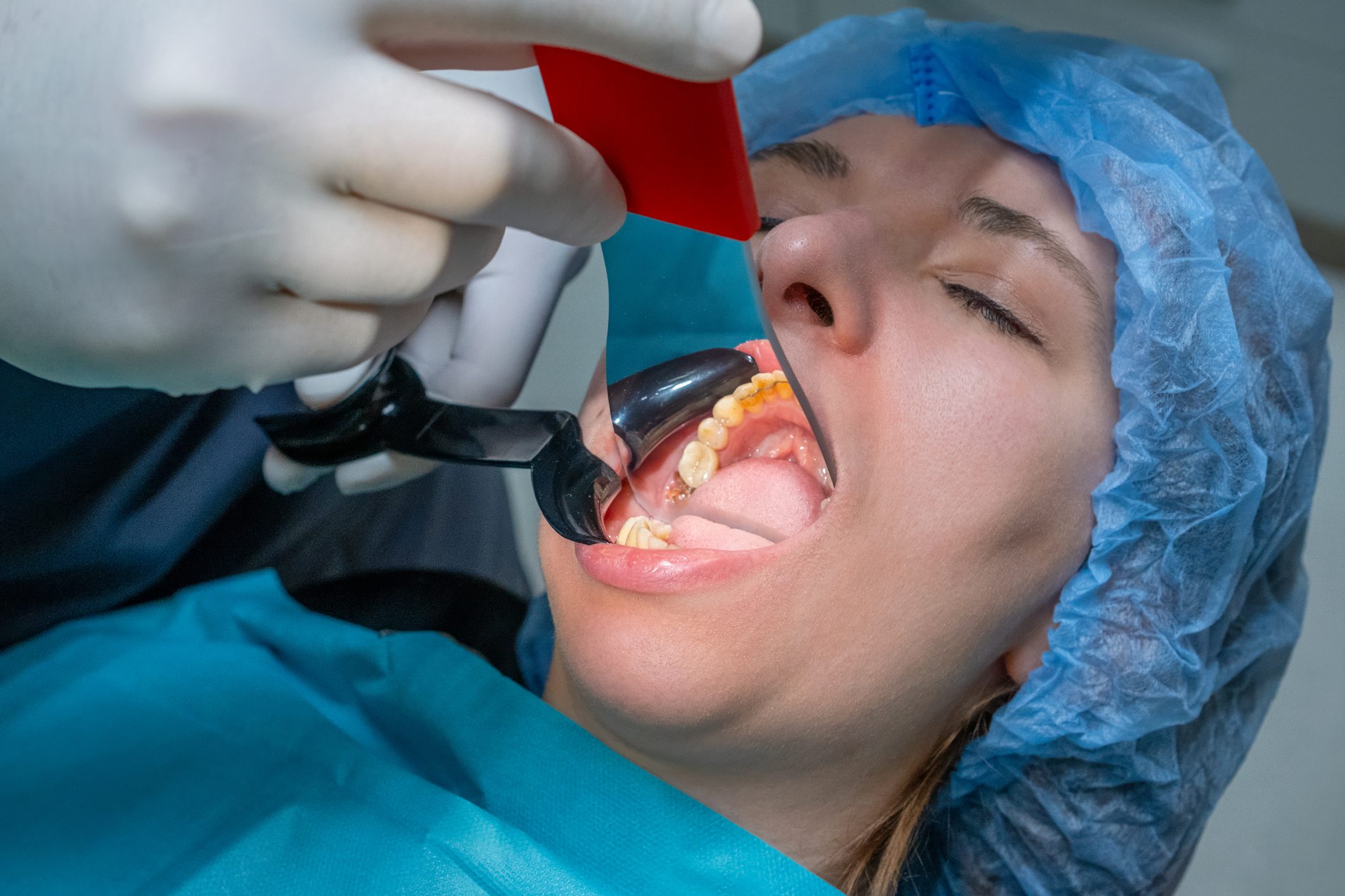 A patient undergoing a dental or oral examination with a light tool.