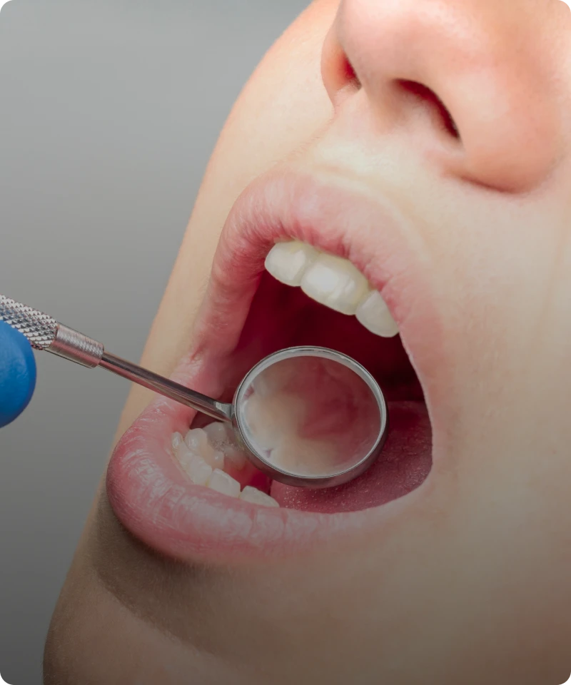 Open mouth during dental examination